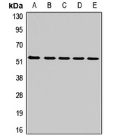 MT-ND4 Rabbit Polyclonal Antibody