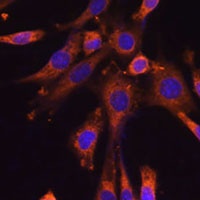 SUV3 Rabbit Polyclonal Antibody