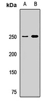 TRIP12 Rabbit Polyclonal Antibody