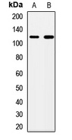 PMPCA Rabbit Polyclonal Antibody