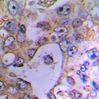 UCP2 Rabbit Polyclonal Antibody