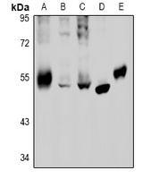 GABRB2 Rabbit Polyclonal Antibody