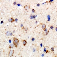 GABRB2 Rabbit Polyclonal Antibody