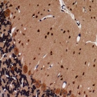 CD144 (Phospho-Y731) Rabbit Polyclonal Antibody