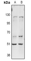 ITPKA Rabbit Polyclonal Antibody