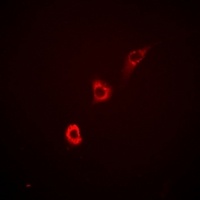 ITPKA Rabbit Polyclonal Antibody