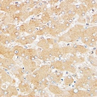 ATG4D Rabbit Polyclonal Antibody