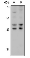 HSD17B2 Rabbit Polyclonal Antibody