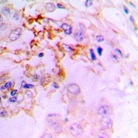 CCL5 Antibody