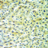 AVP Rabbit Polyclonal Antibody