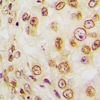 Ki67 Antibody