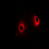mGLUR7 Rabbit Polyclonal Antibody