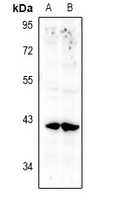 Annexin A10 Rabbit Polyclonal Antibody