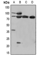Beta-catenin (Phospho-Y670) Rabbit Polyclonal Antibody
