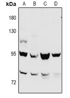 Beta-catenin Rabbit Polyclonal Antibody