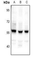 CEP55 Rabbit Polyclonal Antibody