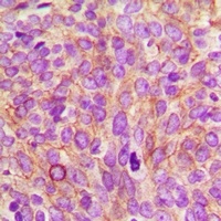 CEP55 Rabbit Polyclonal Antibody