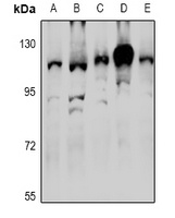 RNF111 Rabbit Polyclonal Antibody