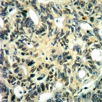 MNK2 (Phospho-T249) Antibody