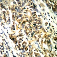 LAT (Phospho-Y161) Antibody