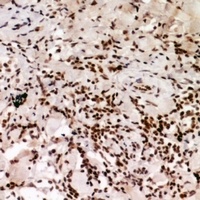 HP1 alpha (Phospho-S92) Antibody