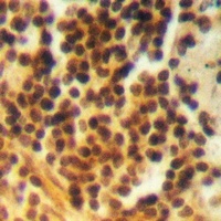 BRK (Phospho-Y342) Rabbit Polyclonal Antibody