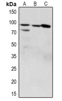 ZAK (Phospho-S165) Rabbit Polyclonal Antibody
