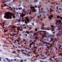 ZAK (Phospho-S165) Rabbit Polyclonal Antibody