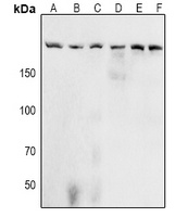 Acinus (Phospho-S1180) Rabbit Polyclonal Antibody