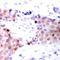 NACA1 (Phospho-S43) Rabbit Polyclonal Antibody
