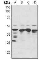 SRF Rabbit Polyclonal Antibody