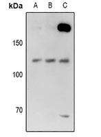 USP28 Rabbit Polyclonal Antibody