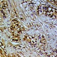DNA Polymerase iota Rabbit Polyclonal Antibody