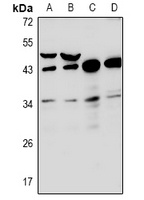 RNF144B Rabbit Polyclonal Antibody