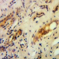 RNF144B Rabbit Polyclonal Antibody