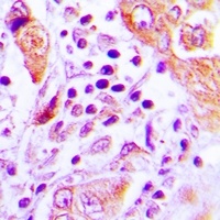 GFM2 Rabbit Polyclonal Antibody