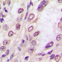 EIF2AK1 Rabbit Polyclonal Antibody