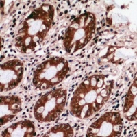 GRTP1 Rabbit Polyclonal Antibody