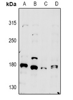 MYO5A Rabbit Polyclonal Antibody