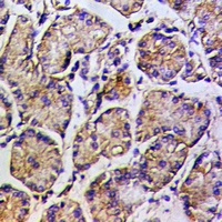 MYO5A Rabbit Polyclonal Antibody