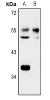 NARFL Rabbit Polyclonal Antibody
