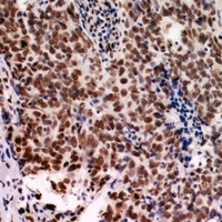 NARFL Rabbit Polyclonal Antibody