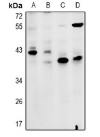 ZDHHC15 Rabbit Polyclonal Antibody