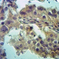 ZDHHC15 Rabbit Polyclonal Antibody