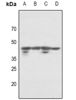 p46 Rabbit Polyclonal Antibody