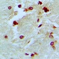 p46 Rabbit Polyclonal Antibody
