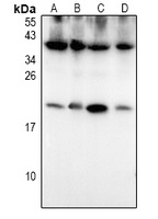 S100-P Rabbit Polyclonal Antibody