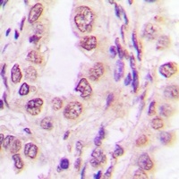 S100-P Rabbit Polyclonal Antibody