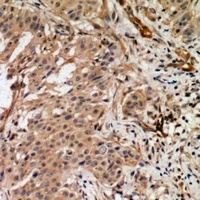 RAB3GAP2 Rabbit Polyclonal Antibody