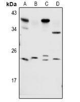 RAB1B Rabbit Polyclonal Antibody
